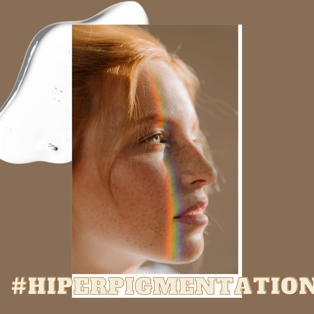 hiperpigmentacije