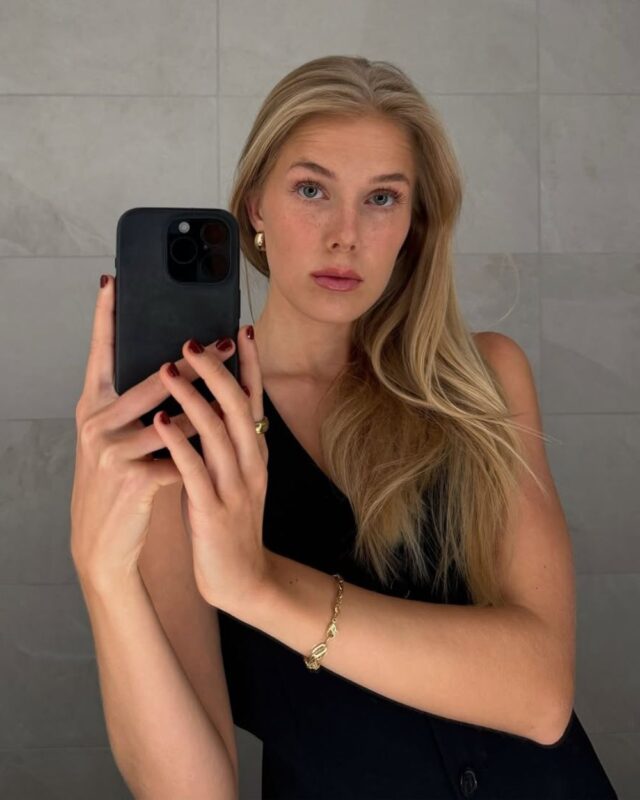 Tamne fleke na licu od ekrana telefona i laptopa? Da, i to se dešava!