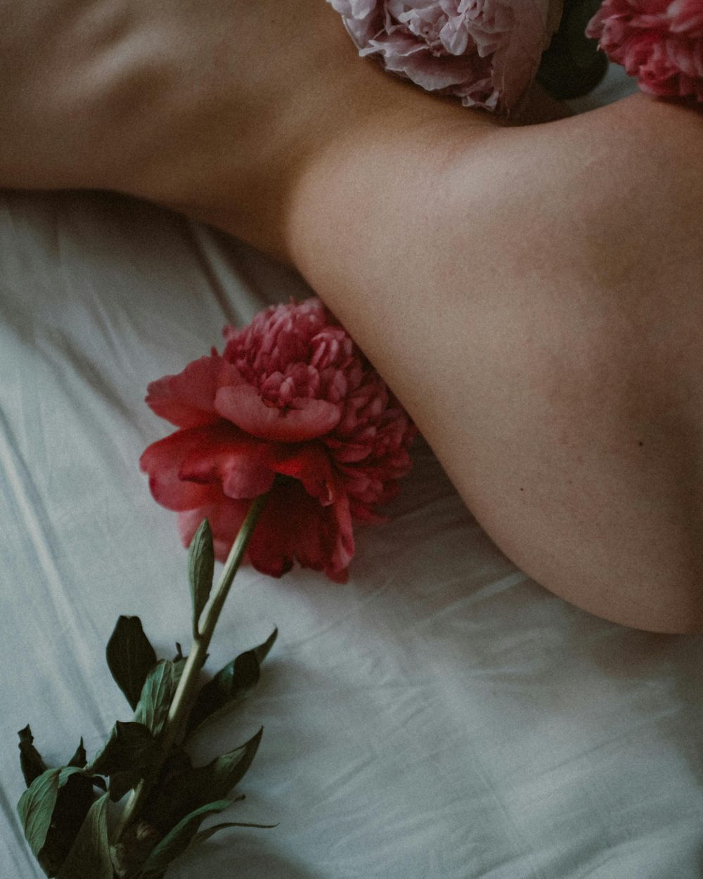vaginalne infekcije (1)