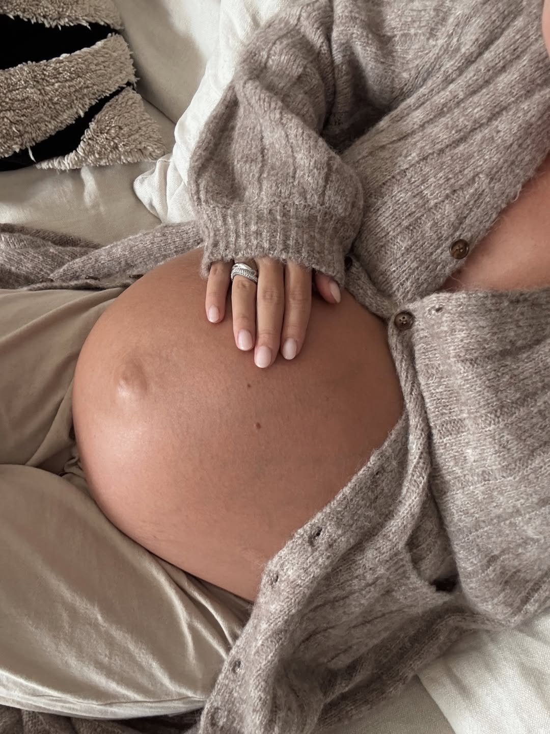 Nega kože stomaka u trdunoći