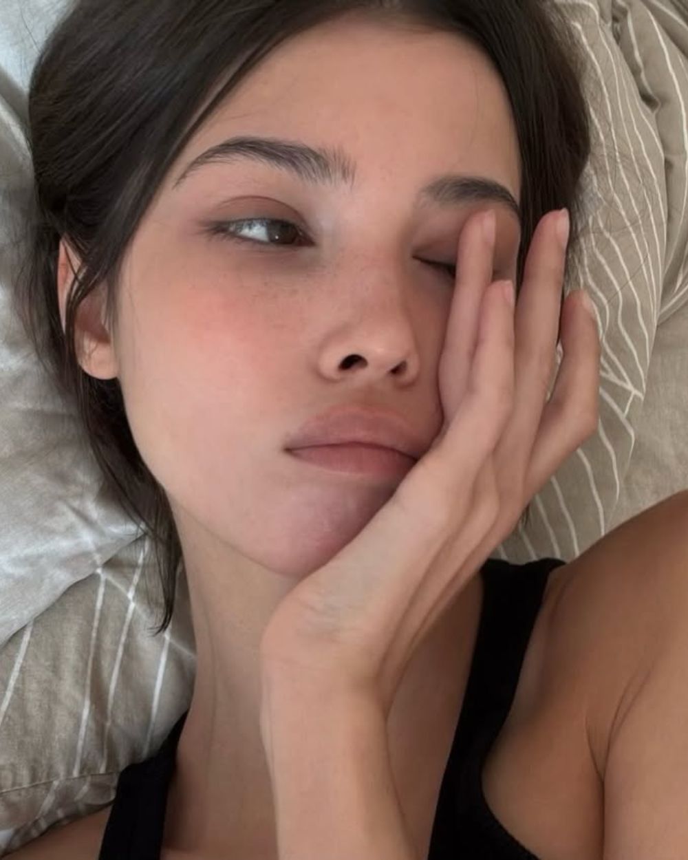 Otečeni kapci ujutro