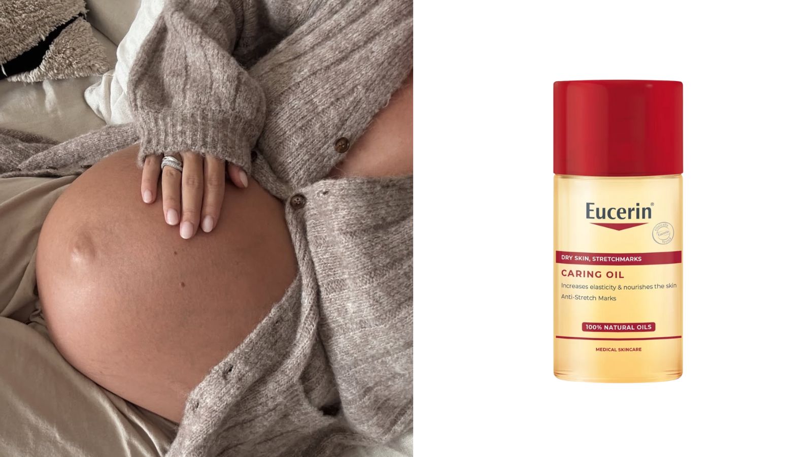 Nega kože stomaka u trudnoći