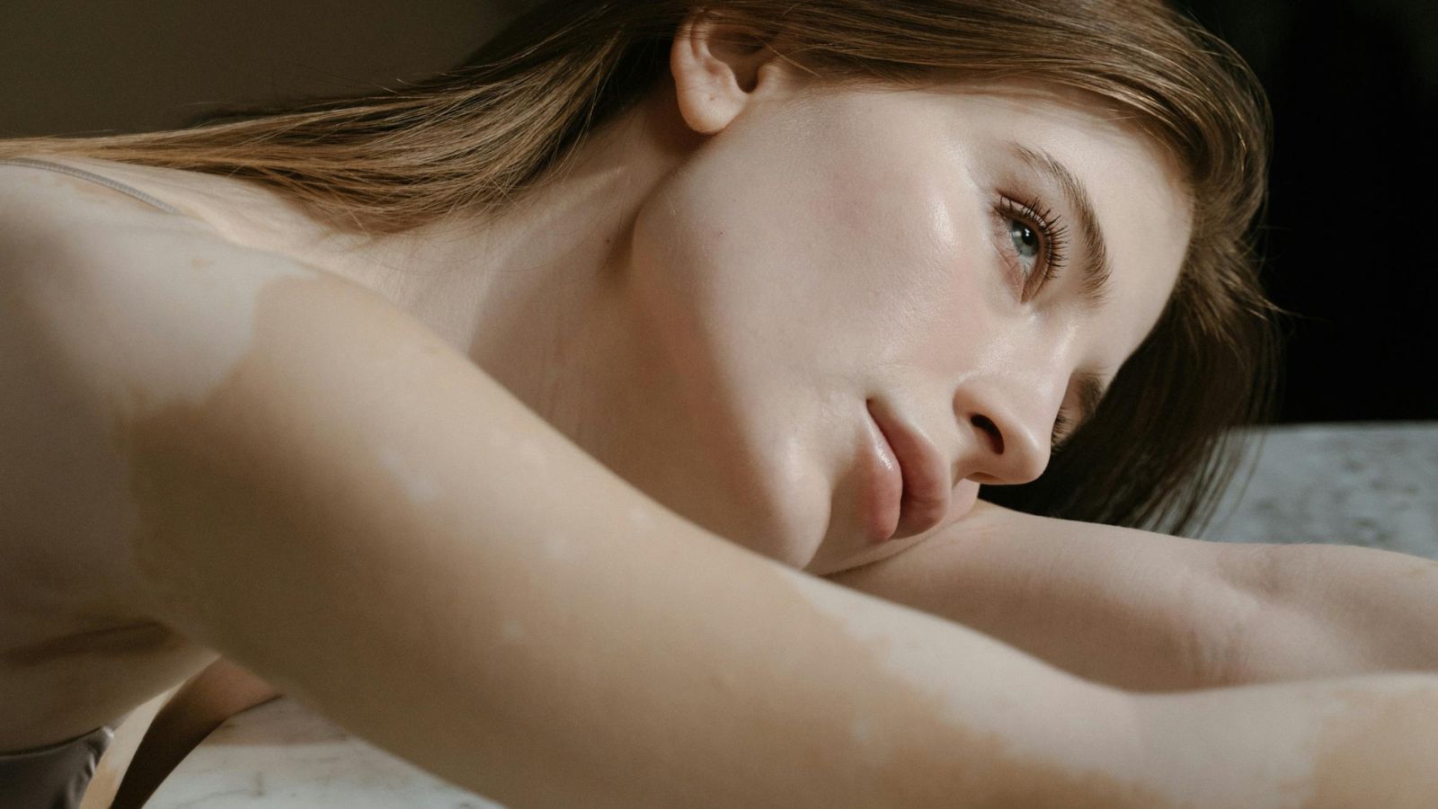 Promene na koži izazvane dijabetesom