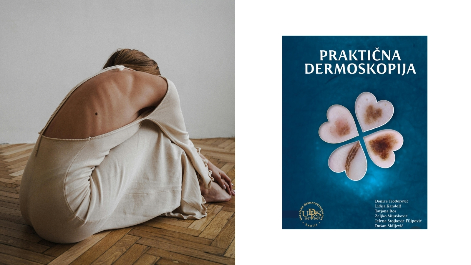 Knjiga praktična dermoskopija