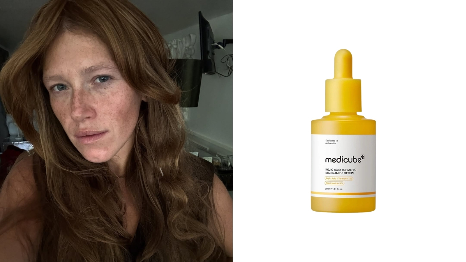 Staračke pege i serumi nega